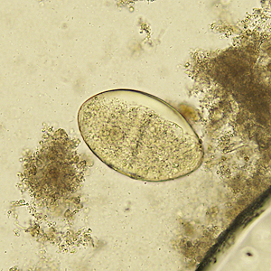 Case329_B.jpg