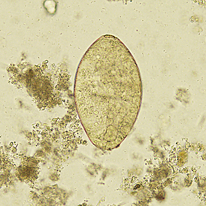 Case329_C.jpg