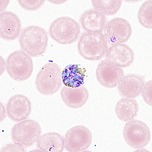 Case330_D.jpg