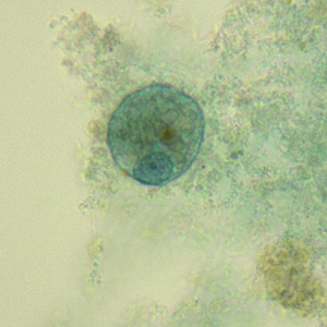 Case331_B.jpg