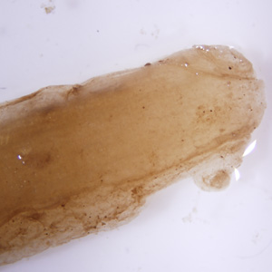 Case332_B.jpg