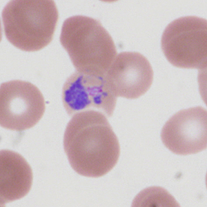 Case335_C.jpg