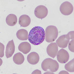 Case335_I.jpg