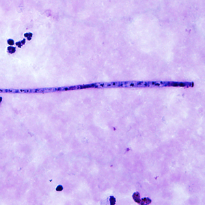 Case339_B.jpg
