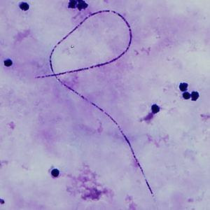 Case339_D.jpg