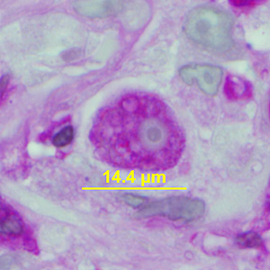 Case341_B.jpg