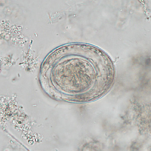 Case342_C.jpg