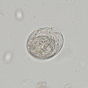 Case342_D.jpg