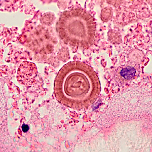 Case345_A.jpg