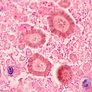 Case345_B.jpg