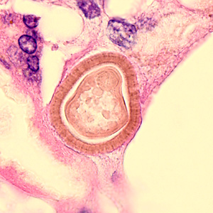 Case345_C.jpg