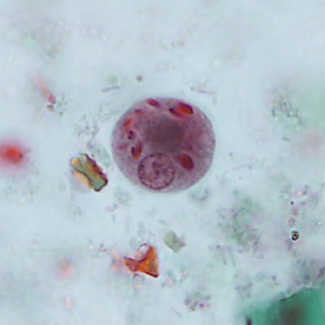 Case346_C.jpg