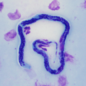 May - 2013 - Case #347