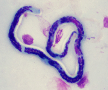 Case347_B.jpg