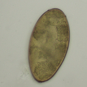 Case348_B.jpg