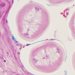 Case352_C.jpg