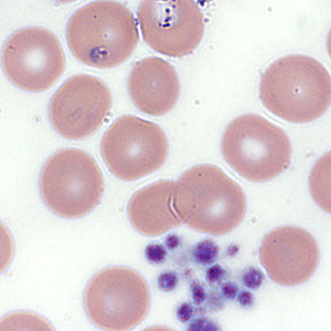 Case354_B.jpg