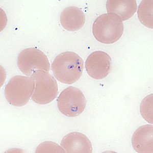 Case354_E.jpg