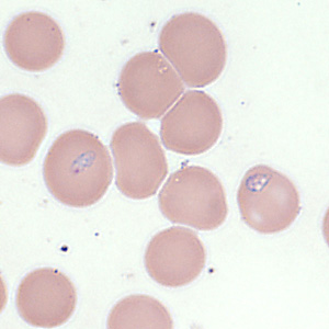Case354_F.jpg