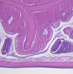 Case355_D.jpg
