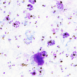 Case357_A.jpg