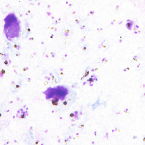 Case357_B.jpg