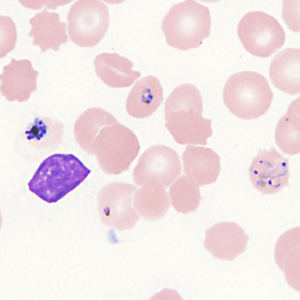 Case357_I.jpg