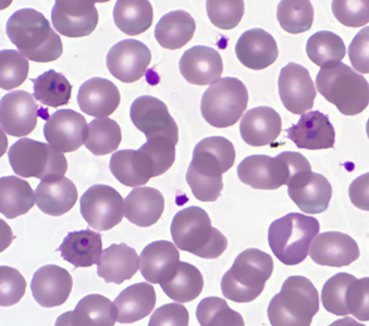 Case359_A.jpg