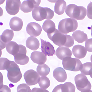 Case359_C.jpg
