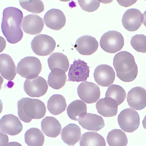 Case359_E.jpg