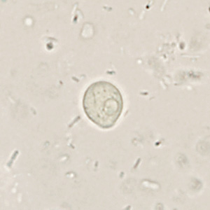 Case361_D.jpg