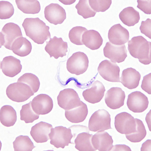 Case362_B.jpg