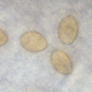 Case363_E.jpg