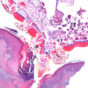 Case364_B.jpg