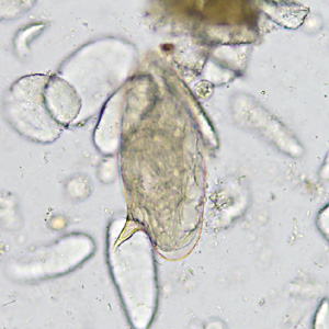 Case365_B.jpg