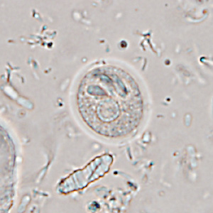 Case365_G.jpg
