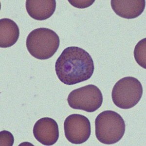 Case368_B.jpg