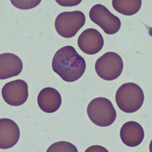 Case368_C.jpg
