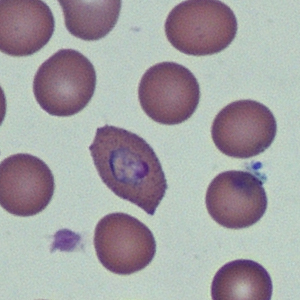 Case368_D.jpg