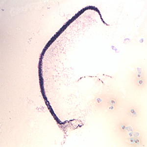Case370_B.jpg