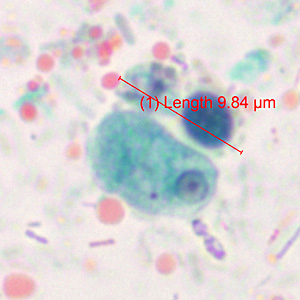 May - 2014 - Case #371