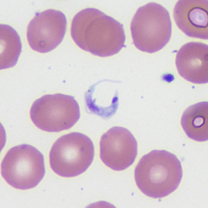 Case372_D.jpg