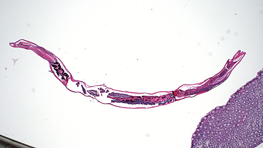 June - 2014 - Case #373