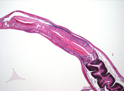 Case373_C.jpg