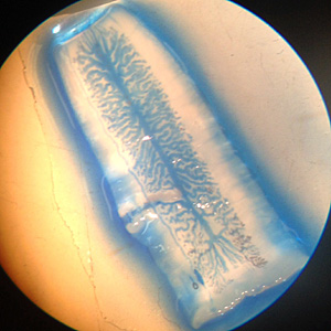 Case375_A.jpg