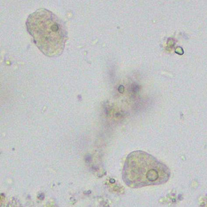 July - 2014 - Case #376