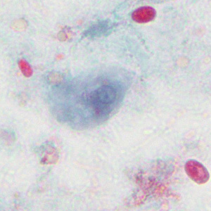 Case376_D.jpg