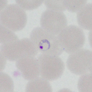 August - 2014 - Case #377