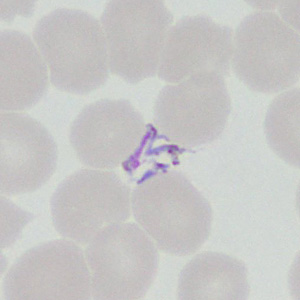 Case377_B.jpg