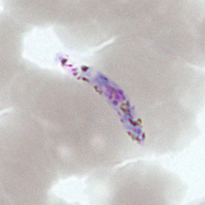 Case377_D.jpg